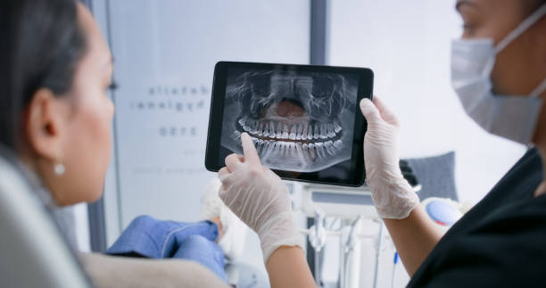 Licensed Tooth Extraction service in Richmond, MN - Smile Center Dentistry